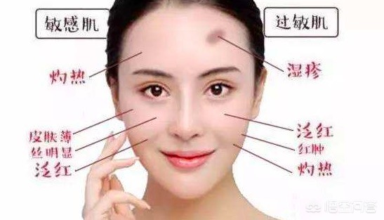 角鲨烷 儿童-润本婴儿面霜有激素吗？