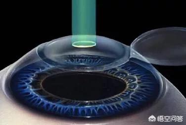 护眼仪对近视眼有帮助吗-孩子九岁近视，护眼仪管用吗？